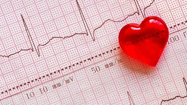 Calculadoras en línea de cardiología