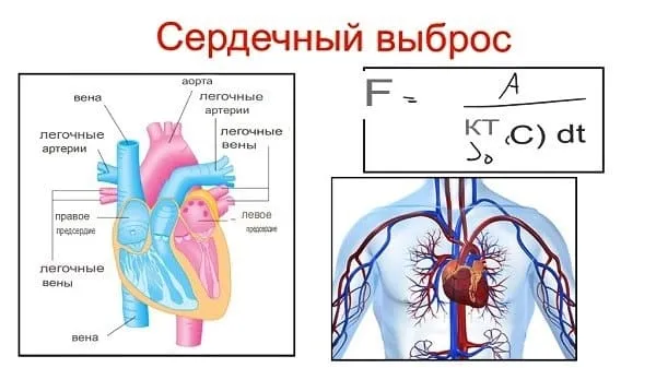 Serdechnyj vybros